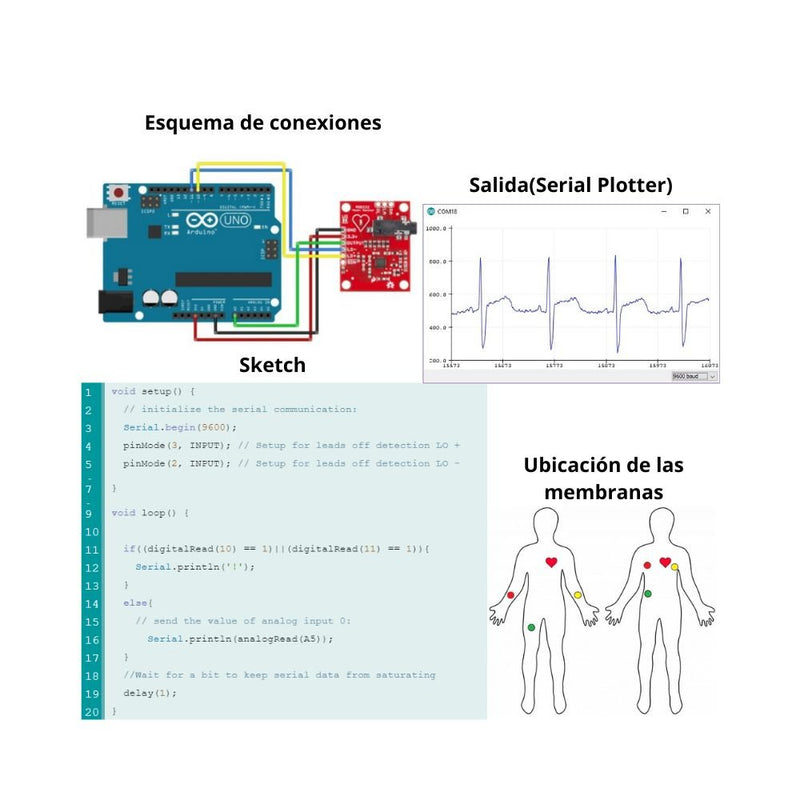 Ad8232 Ecg Kit Módulo Sensor De Pulso Ritmo Cardíaco